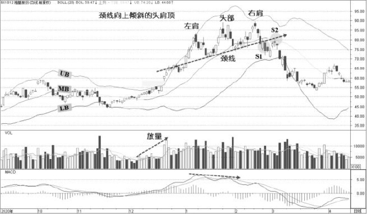 2.5 头肩顶：顶部结构失败常比成功更值得警惕（图 2）